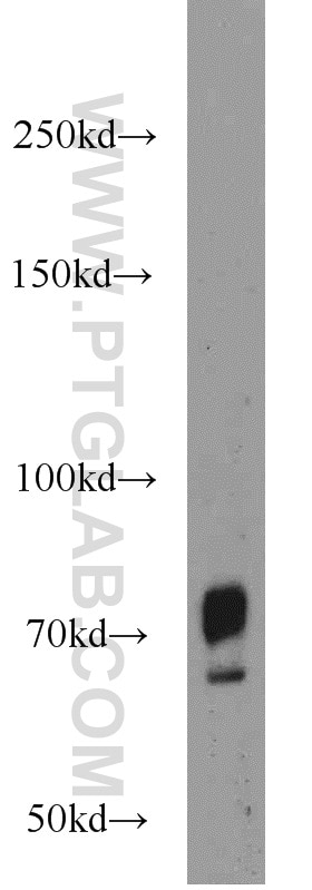 Western Blot (WB) analysis of mouse kidney tissue using SORCS1 Polyclonal antibody (23002-1-AP)