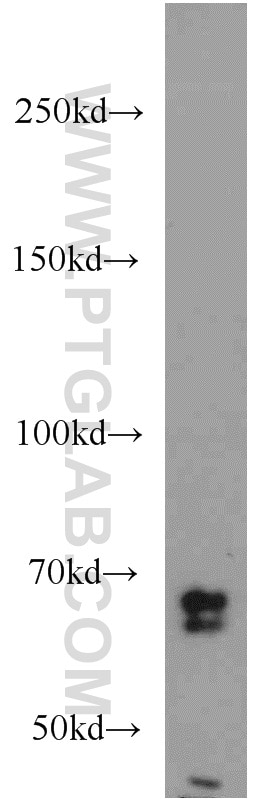 Western Blot (WB) analysis of human brain tissue using SORCS1 Polyclonal antibody (23002-1-AP)