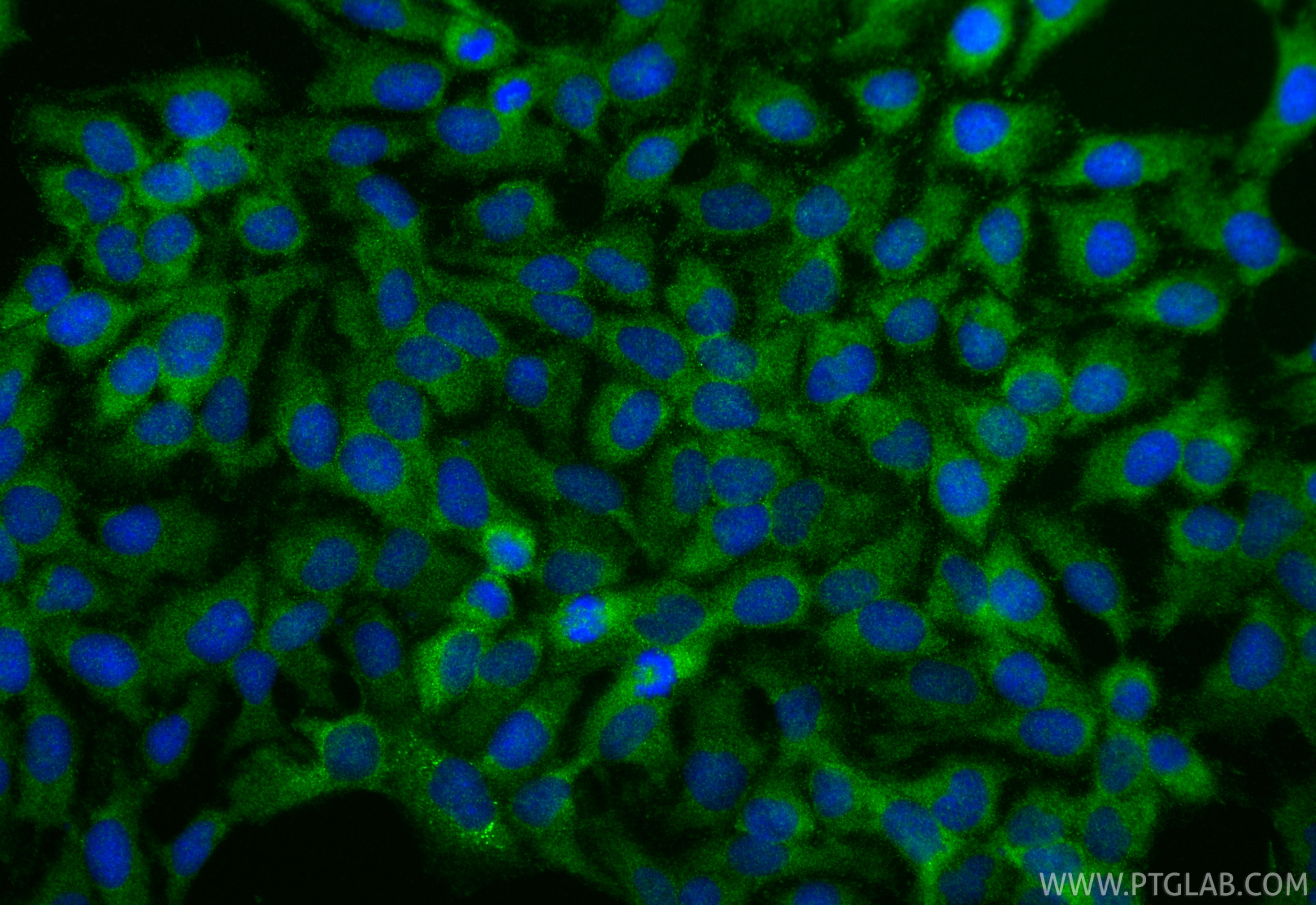 Immunofluorescence (IF) / fluorescent staining of HaCaT cells using SORCS2 Polyclonal antibody (55063-1-AP)