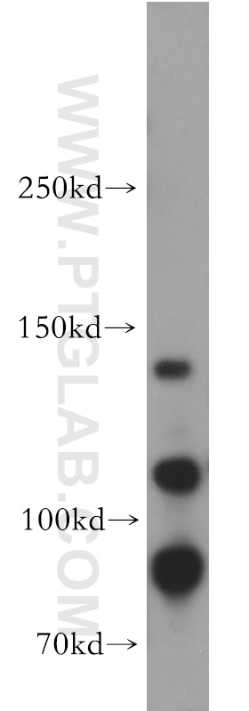 Western Blot (WB) analysis of HEK-293 cells using SORCS2 Polyclonal antibody (55063-1-AP)