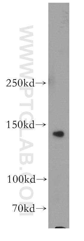Western Blot (WB) analysis of Jurkat cells using SORCS2 Polyclonal antibody (55063-1-AP)