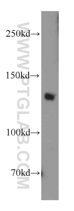 Western Blot (WB) analysis of mouse brain tissue using SORCS2 Polyclonal antibody (55063-1-AP)