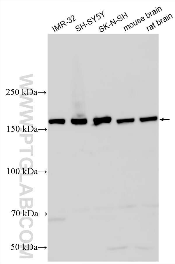 WB analysis using 32248-1-AP (same clone as 32248-1-PBS) Western Blot (WB) analysis of various lysates using SORCS3 Polyclonal antibody (32248-1-AP)