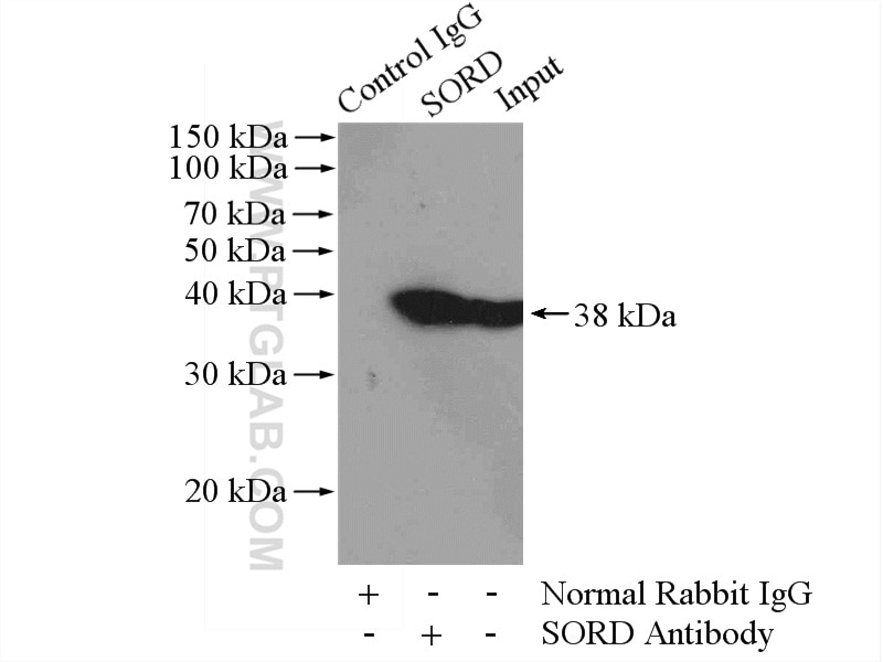 Immunoprecipitation (IP) experiment of mouse liver tissue using Sorbitol dehydrogenase Polyclonal antibody (15881-1-AP)