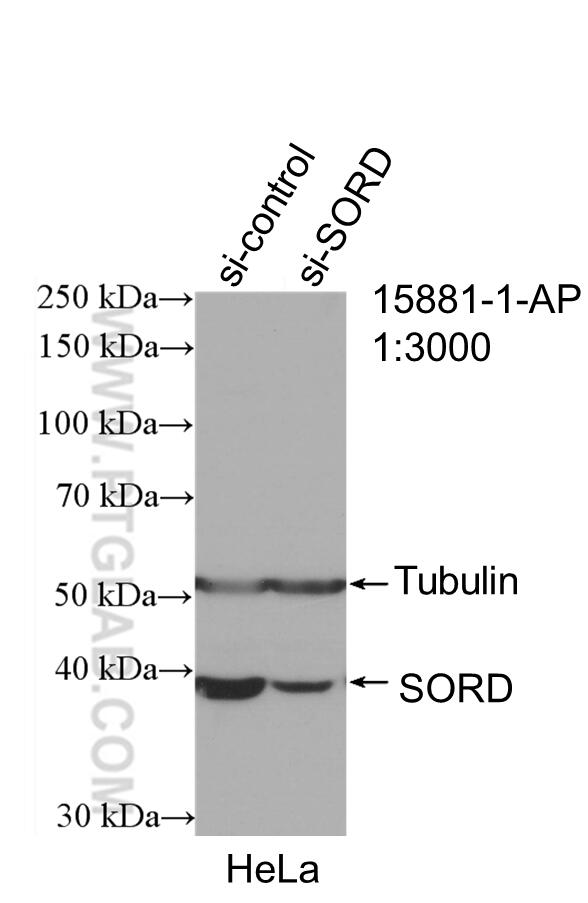 WB analysis of HeLa using 15881-1-AP