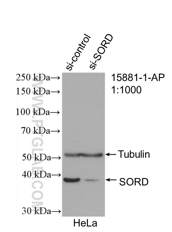 Western Blot (WB) analysis of HeLa cells using Sorbitol dehydrogenase Polyclonal antibody (15881-1-AP)