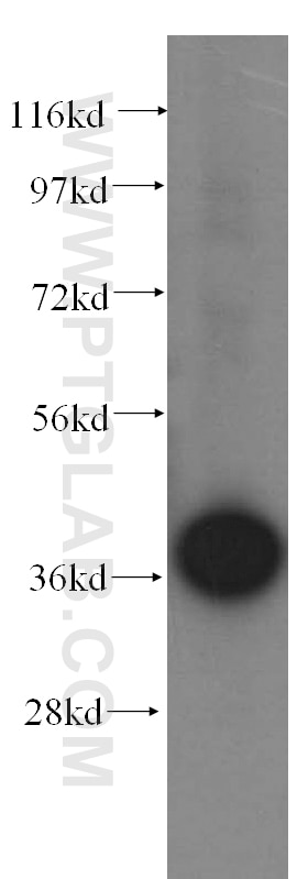 Sorbitol dehydrogenase