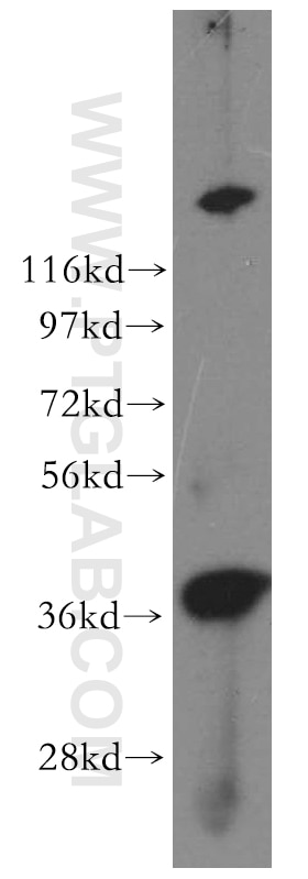 Western Blot (WB) analysis of human kidney tissue using Sorbitol dehydrogenase Polyclonal antibody (15881-1-AP)
