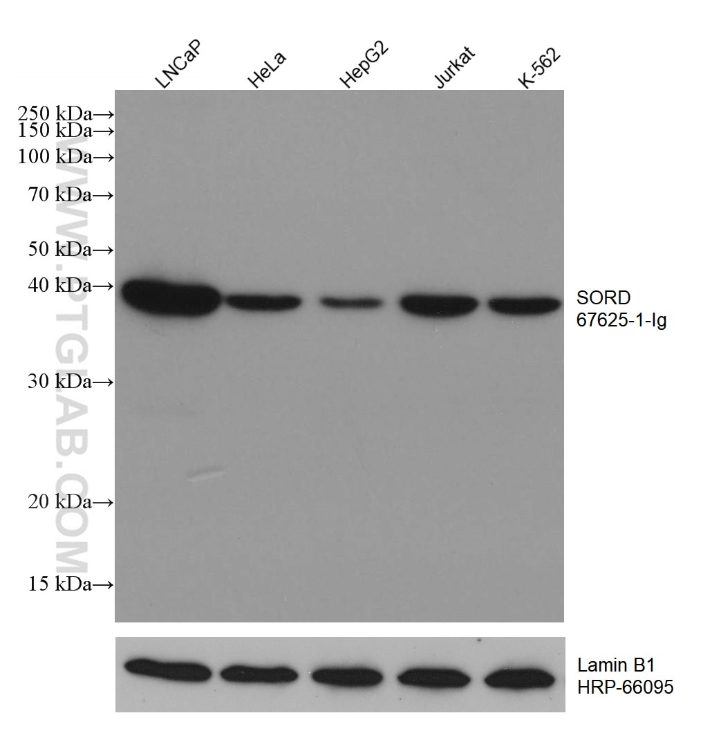 Western Blot (WB) analysis of various lysates using SORD Monoclonal antibody (67625-1-Ig)
