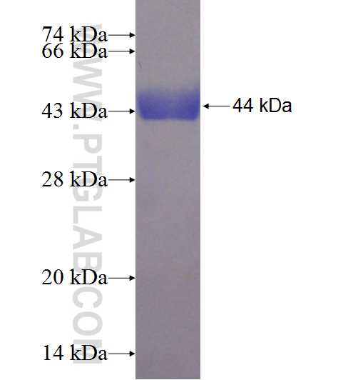 SORD fusion protein Ag8651 SDS-PAGE