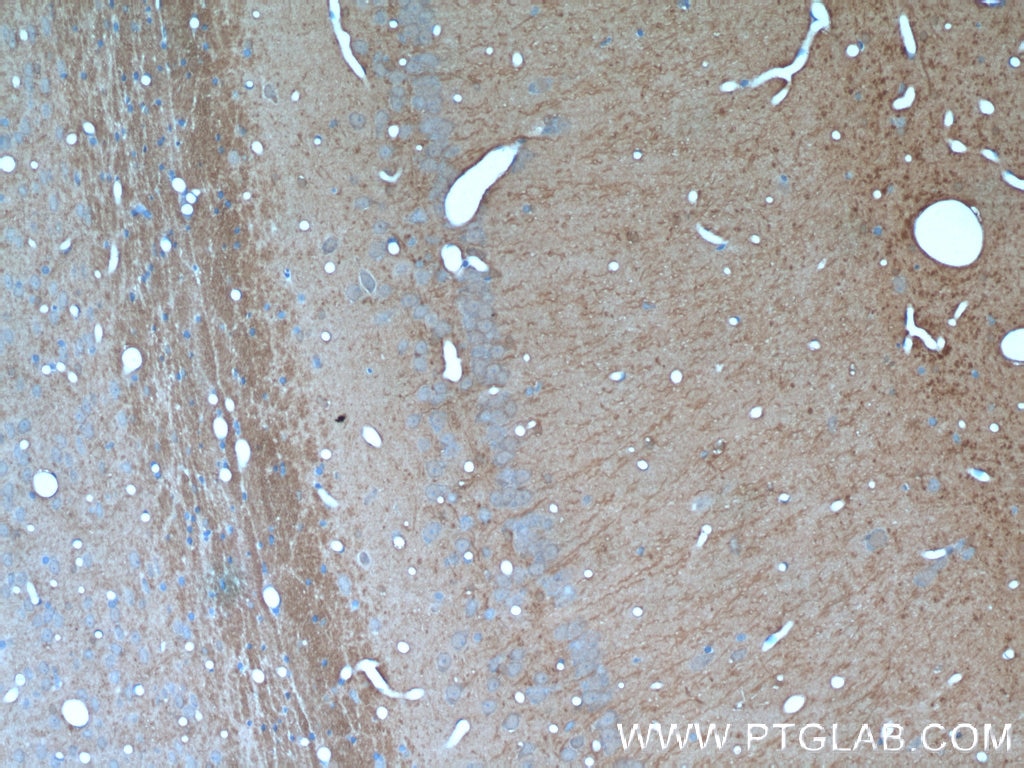 Immunohistochemistry (IHC) staining of rat brain tissue using SORLA Polyclonal antibody (22592-1-AP)