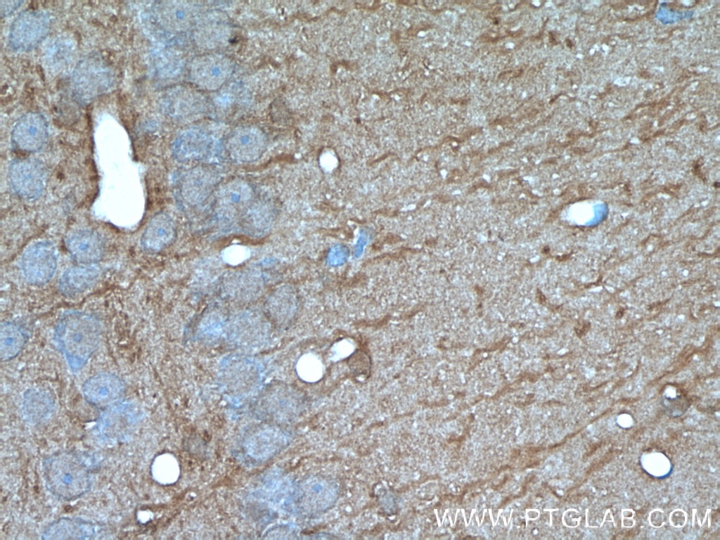 Immunohistochemistry (IHC) staining of rat brain tissue using SORLA Polyclonal antibody (22592-1-AP)