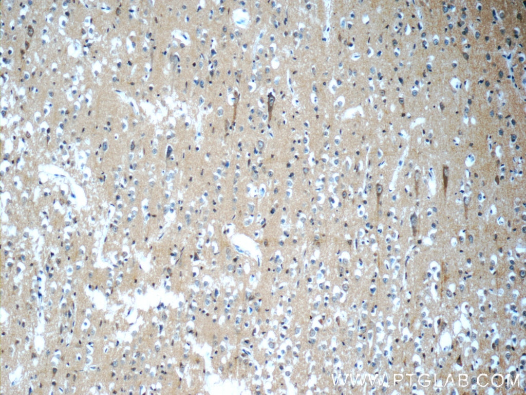 Immunohistochemistry (IHC) staining of human brain tissue using SORLA Polyclonal antibody (22592-1-AP)