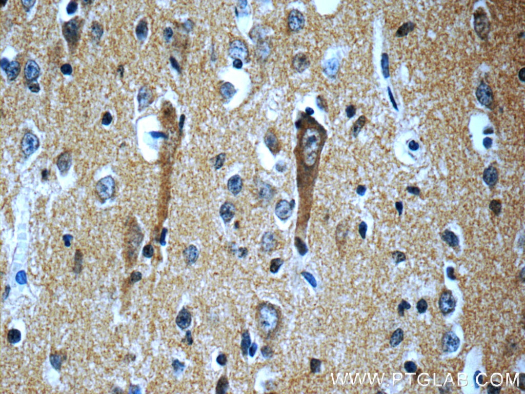 Immunohistochemistry (IHC) staining of human brain tissue using SORLA Polyclonal antibody (22592-1-AP)