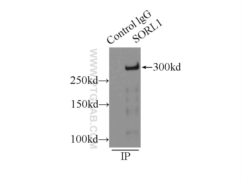 Immunoprecipitation (IP) experiment of mouse brain tissue using SORLA Polyclonal antibody (22592-1-AP)