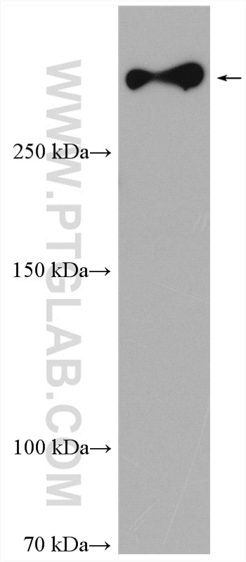 Western Blot (WB) analysis of mouse brain tissue using SORLA Polyclonal antibody (22592-1-AP)