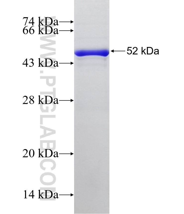SORL1 fusion protein Ag32622 SDS-PAGE SORL1 fusion protein Ag32622 SDS-PAGE