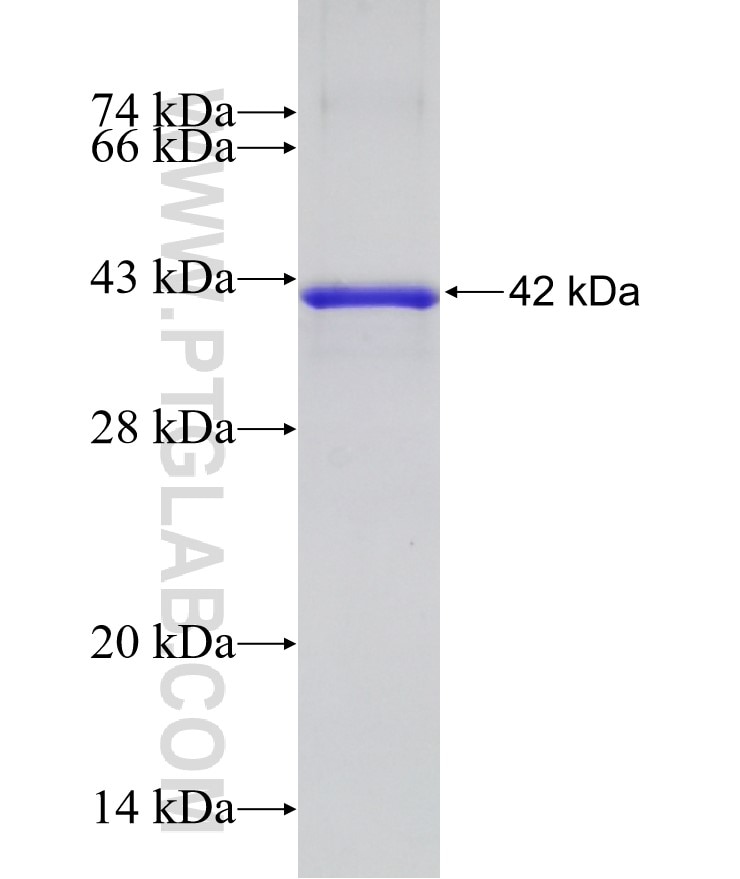 SORL1 fusion protein Ag18445 SDS-PAGE