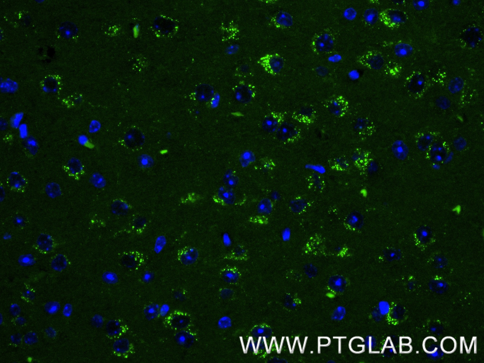 IF Staining of mouse brain using 87882-1-RR Immunofluorescence (IF) / fluorescent staining of mouse brain tissue using SORLA Recombinant monoclonal antibody (87882-1-RR)