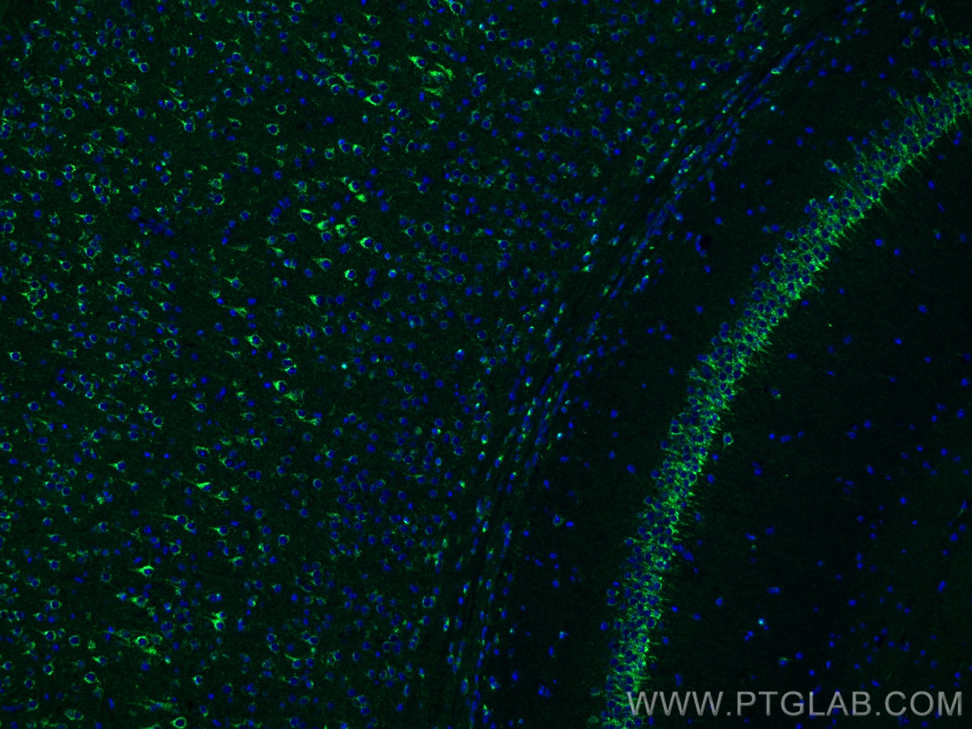 Immunofluorescence (IF) / fluorescent staining of mouse brain tissue using Sortilin Polyclonal antibody (12369-1-AP)