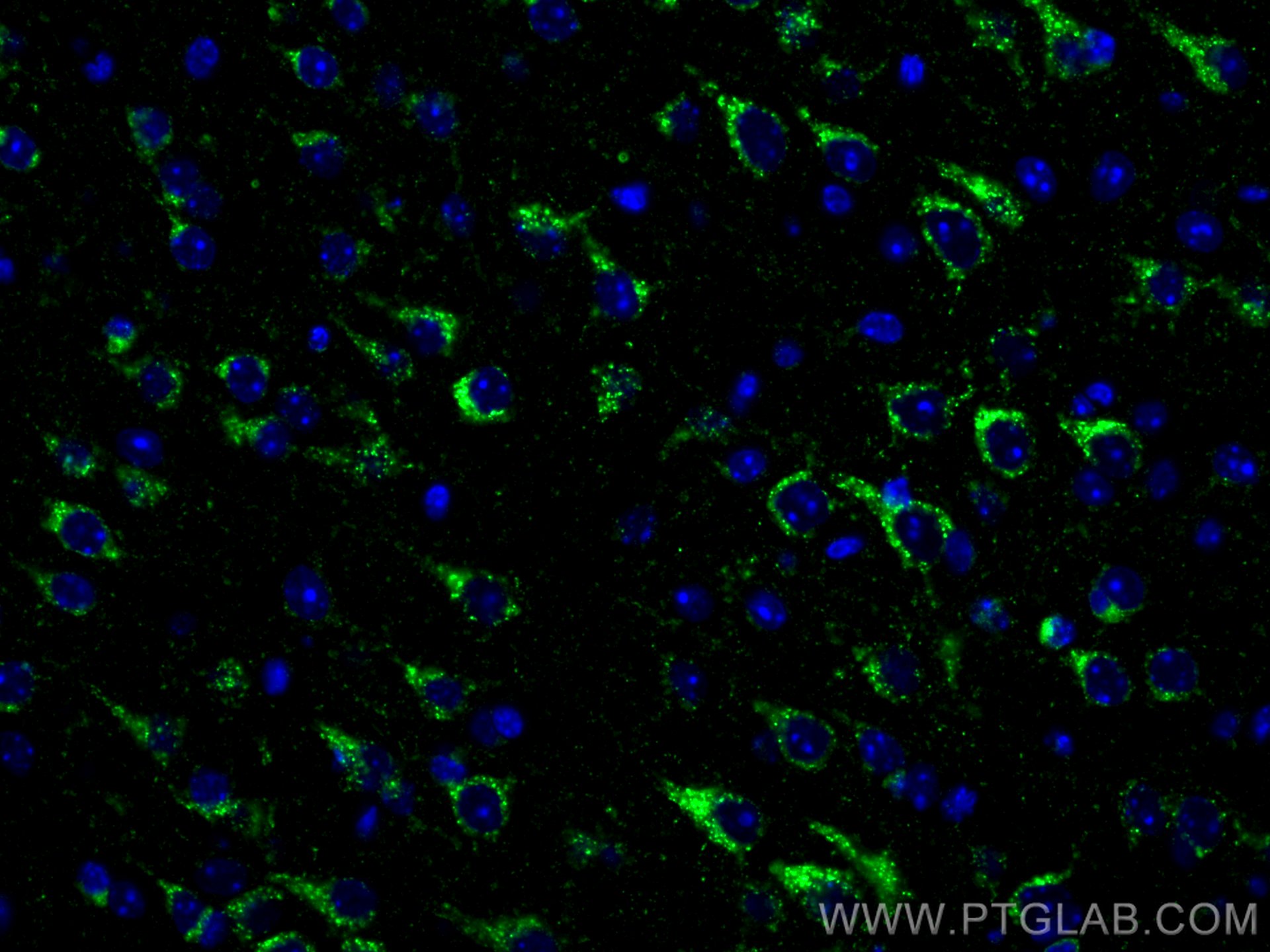 IF Staining of mouse brain using 12369-1-AP