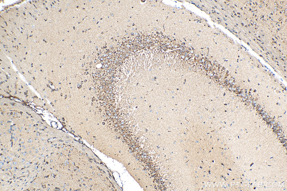 IHC staining of mouse brain using 12369-1-AP