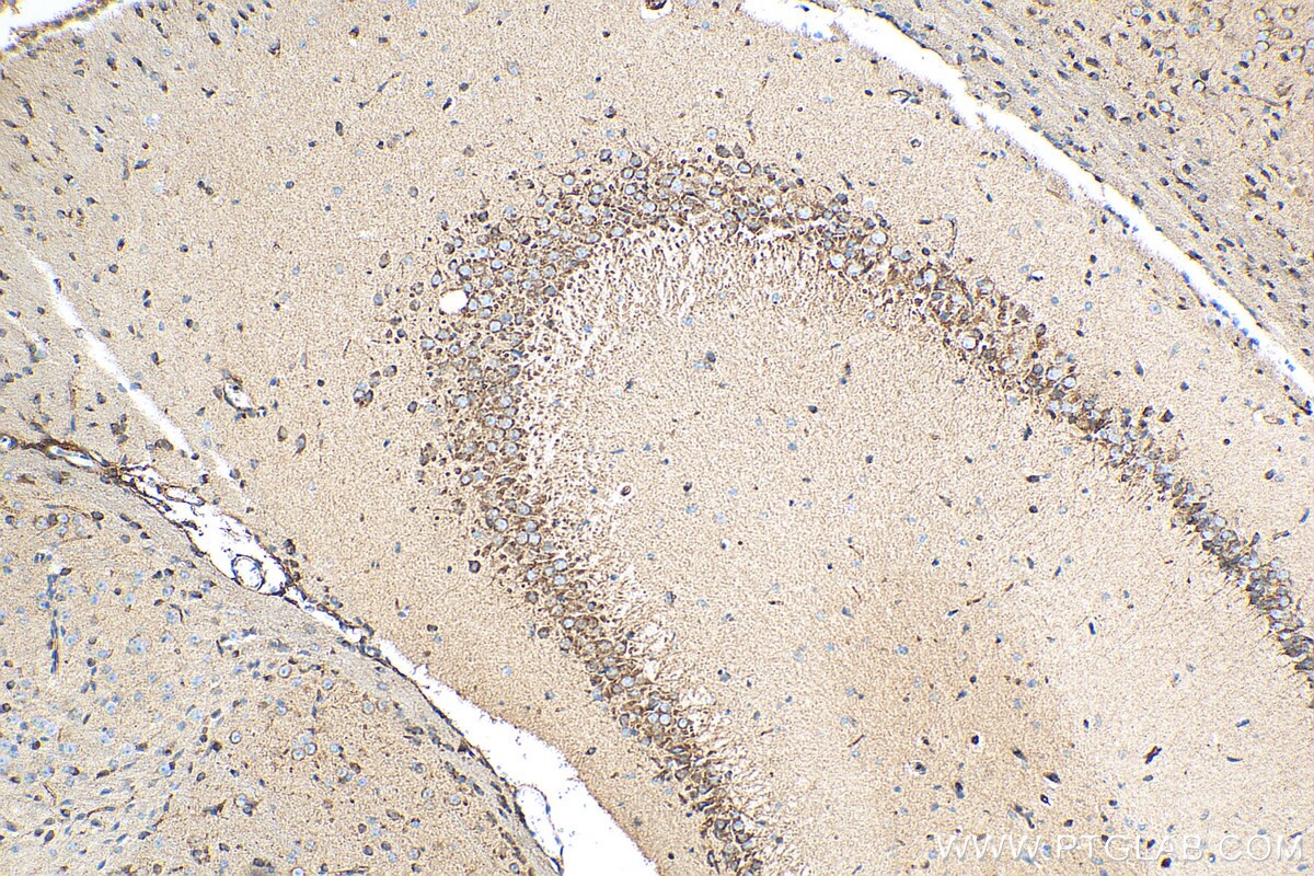 Immunohistochemistry (IHC) staining of mouse brain tissue using Sortilin Polyclonal antibody (12369-1-AP)