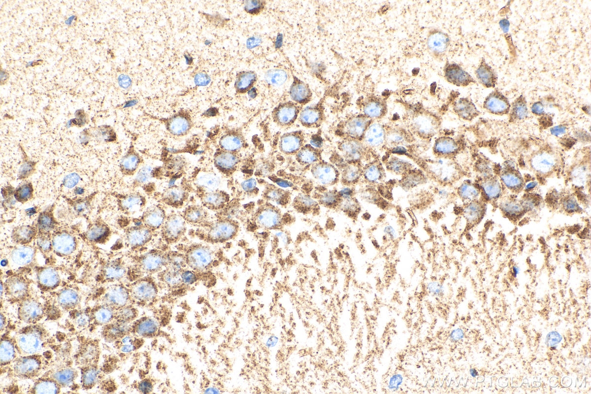 Immunohistochemistry (IHC) staining of mouse brain tissue using Sortilin Polyclonal antibody (12369-1-AP)