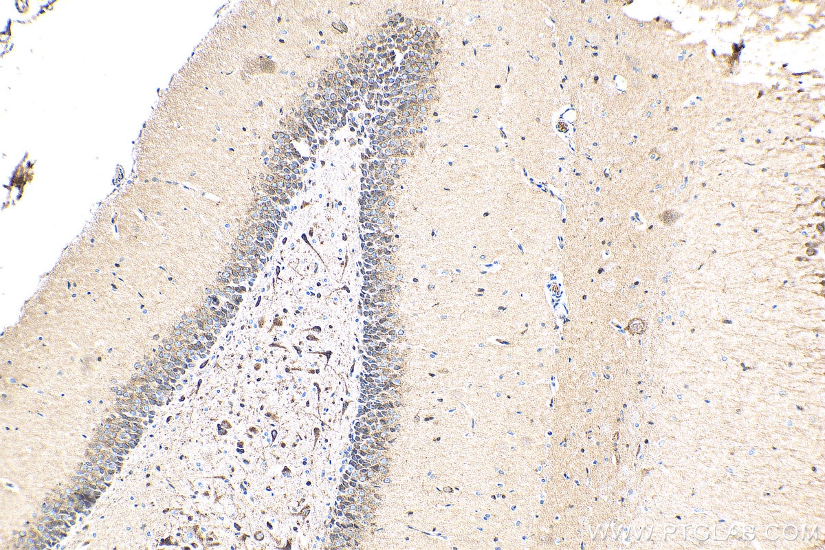 Immunohistochemistry (IHC) staining of rat brain tissue using Sortilin Polyclonal antibody (12369-1-AP)