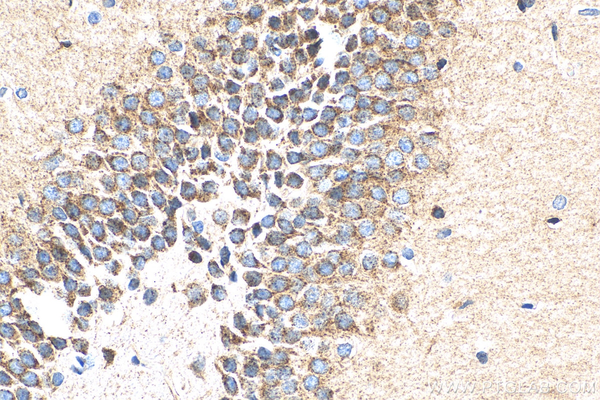 Immunohistochemistry (IHC) staining of rat brain tissue using Sortilin Polyclonal antibody (12369-1-AP)