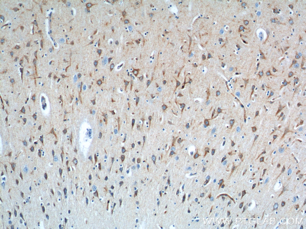 Immunohistochemistry (IHC) staining of human brain tissue using Sortilin Polyclonal antibody (12369-1-AP)