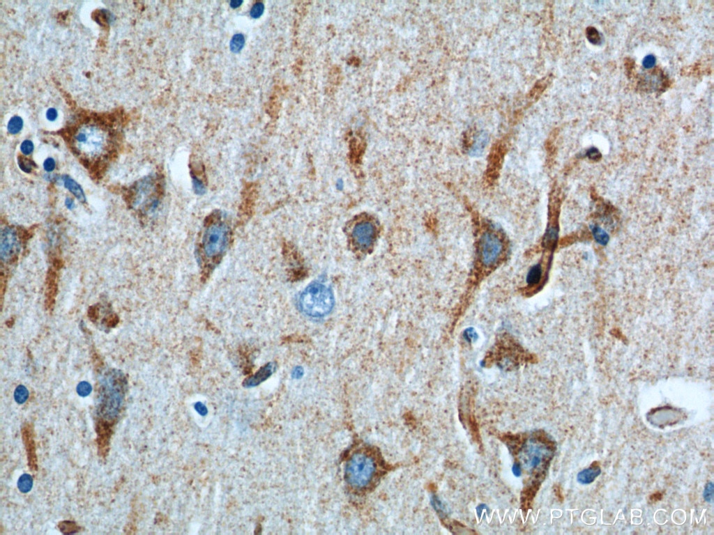 Immunohistochemistry (IHC) staining of human brain tissue using Sortilin Polyclonal antibody (12369-1-AP)