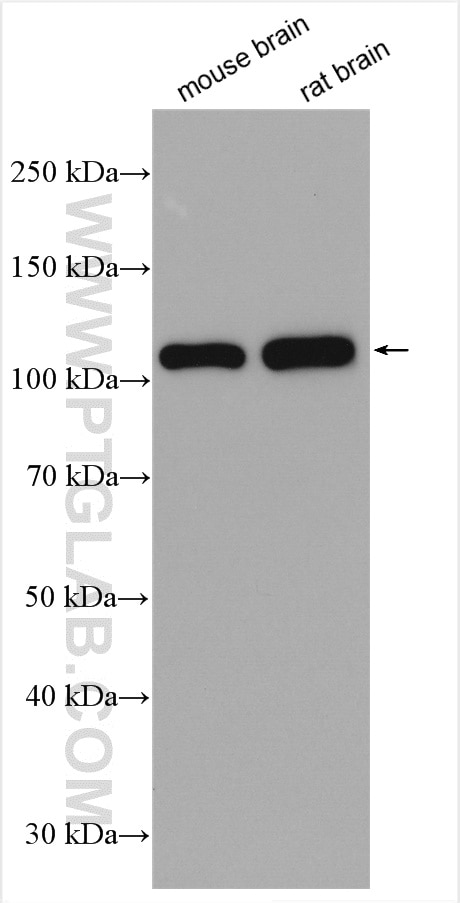 Western Blot (WB) analysis of various lysates using Sortilin Polyclonal antibody (12369-1-AP)