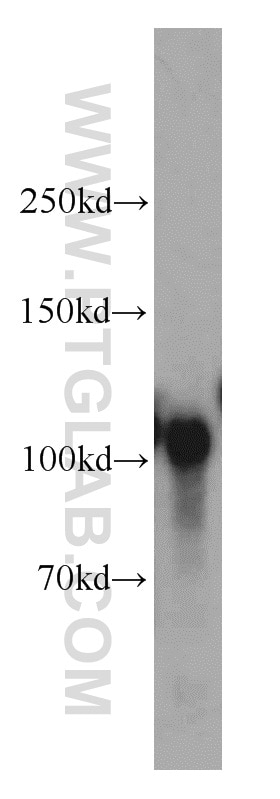 Western Blot (WB) analysis of human brain tissue using Sortilin Polyclonal antibody (12369-1-AP)