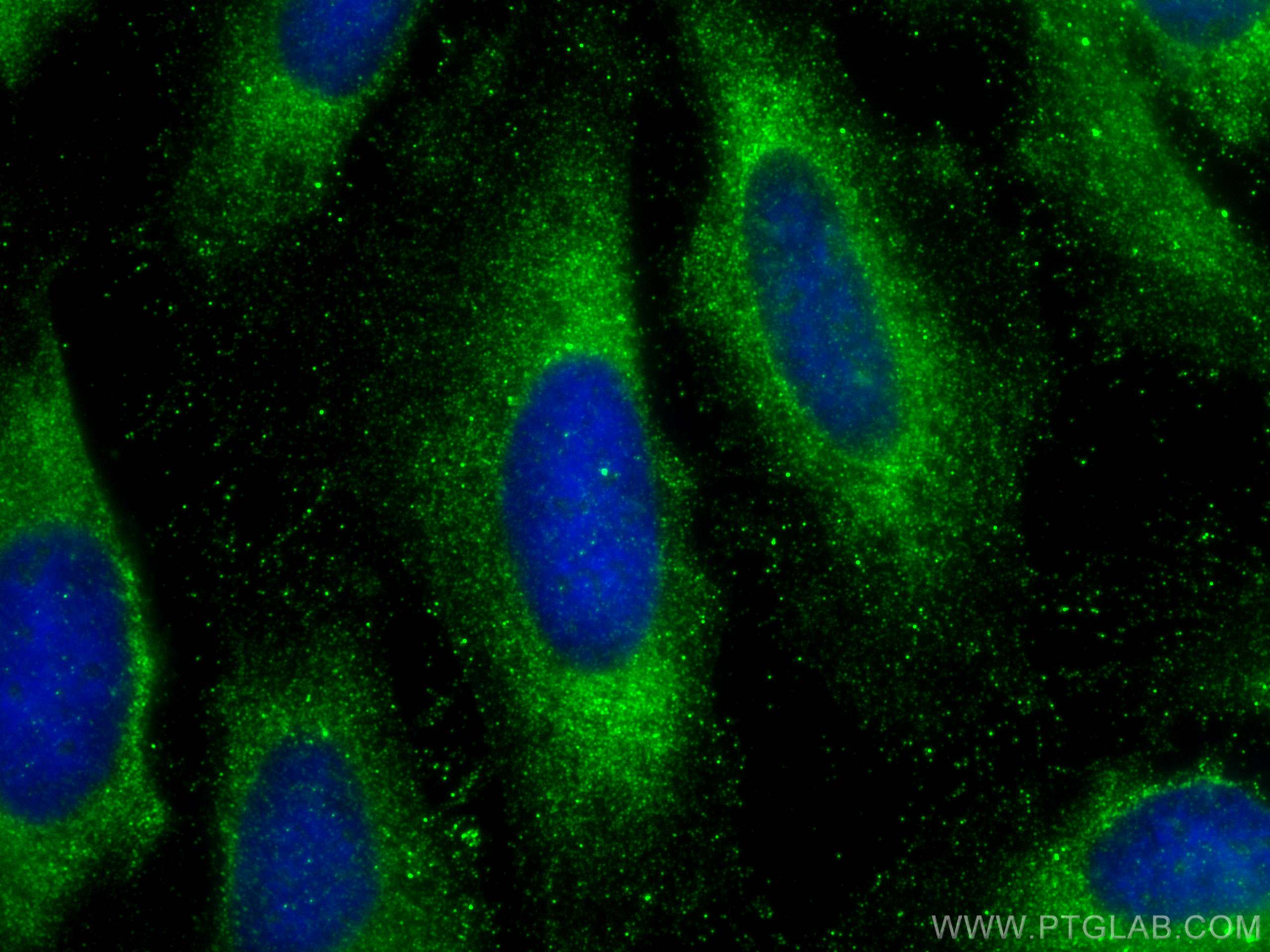 Immunofluorescence (IF) / fluorescent staining of HeLa cells using SOS1 Polyclonal antibody (55041-1-AP)