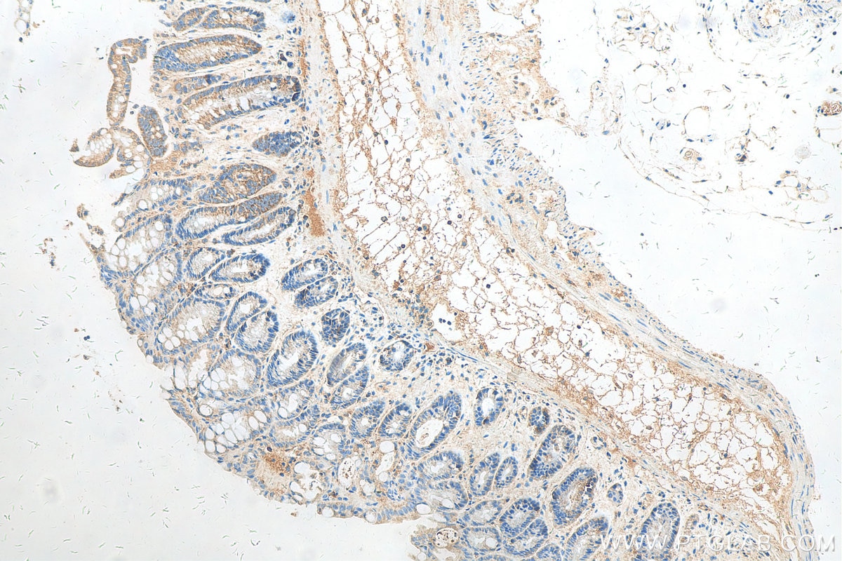 Immunohistochemistry (IHC) staining of mouse colon tissue using SOS1 Polyclonal antibody (55041-1-AP)