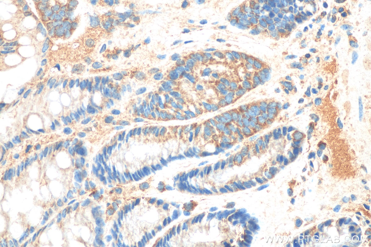Immunohistochemistry (IHC) staining of mouse colon tissue using SOS1 Polyclonal antibody (55041-1-AP)