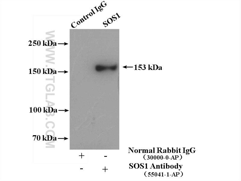 Immunoprecipitation (IP) experiment of mouse brain tissue using SOS1 Polyclonal antibody (55041-1-AP)