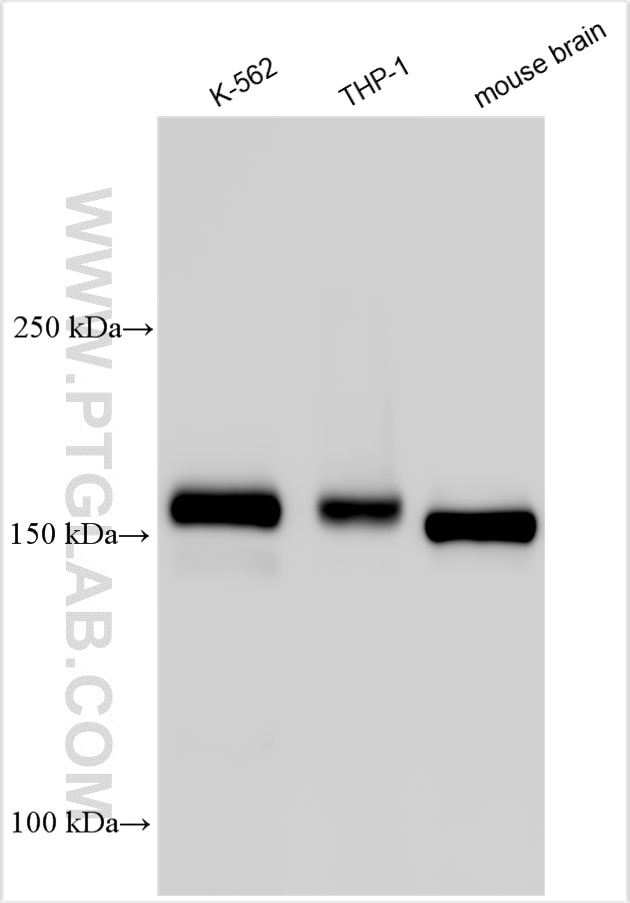 Western Blot (WB) analysis of various lysates using SOS1 Polyclonal antibody (55041-1-AP)