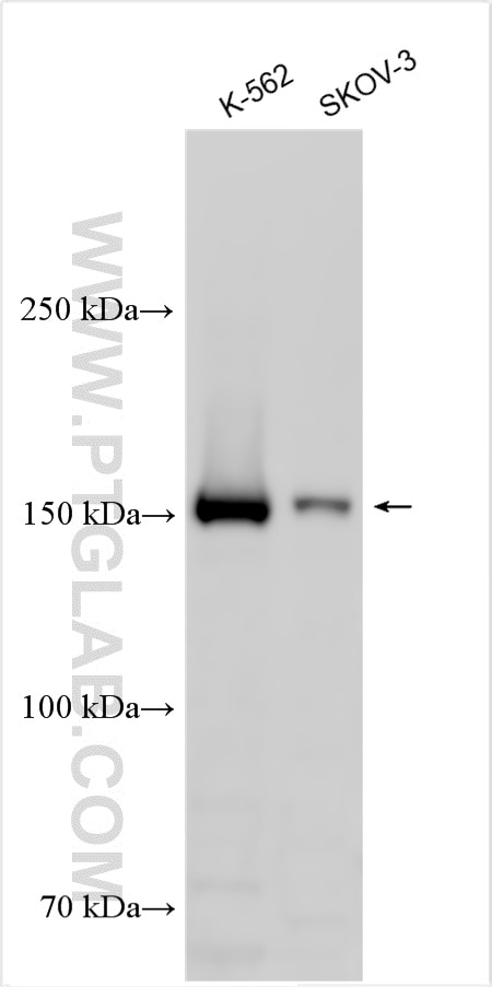 Western Blot (WB) analysis of various lysates using SOS1 Polyclonal antibody (55041-1-AP)