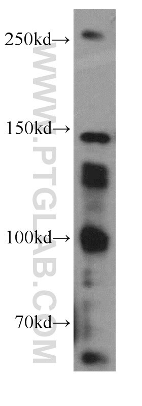 Western Blot (WB) analysis of mouse brain tissue using SOS1 Polyclonal antibody (55041-1-AP)