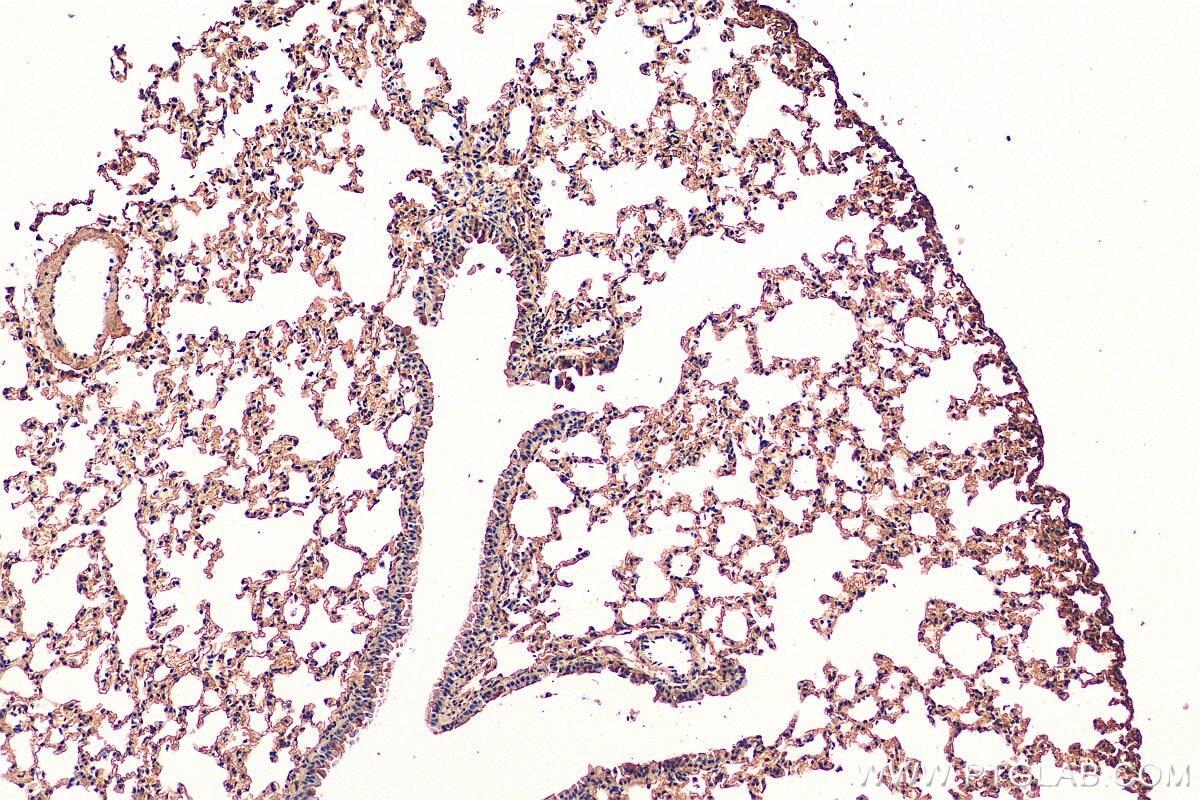 Immunohistochemistry (IHC) staining of mouse lung tissue using Sclerostin Polyclonal antibody (21933-1-AP)