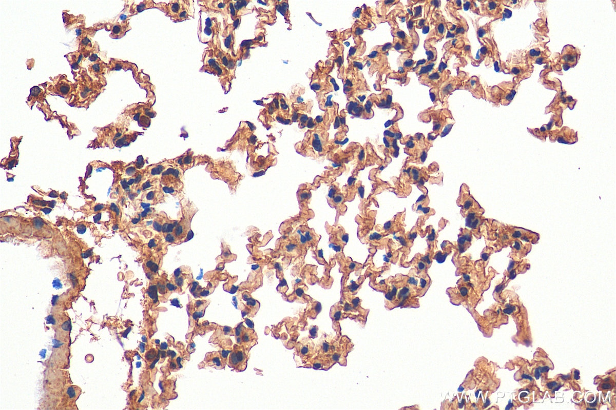 Immunohistochemistry (IHC) staining of mouse lung tissue using Sclerostin Polyclonal antibody (21933-1-AP)