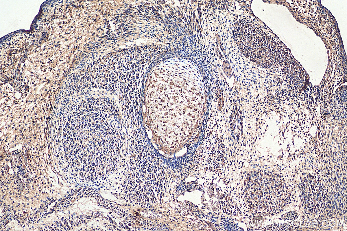 Immunohistochemistry (IHC) staining of mouse embryo tissue using Sclerostin Polyclonal antibody (21933-1-AP)