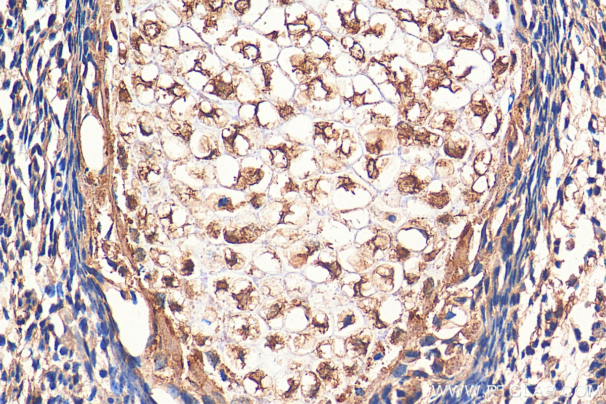 IHC staining of mouse embryo using 21933-1-AP