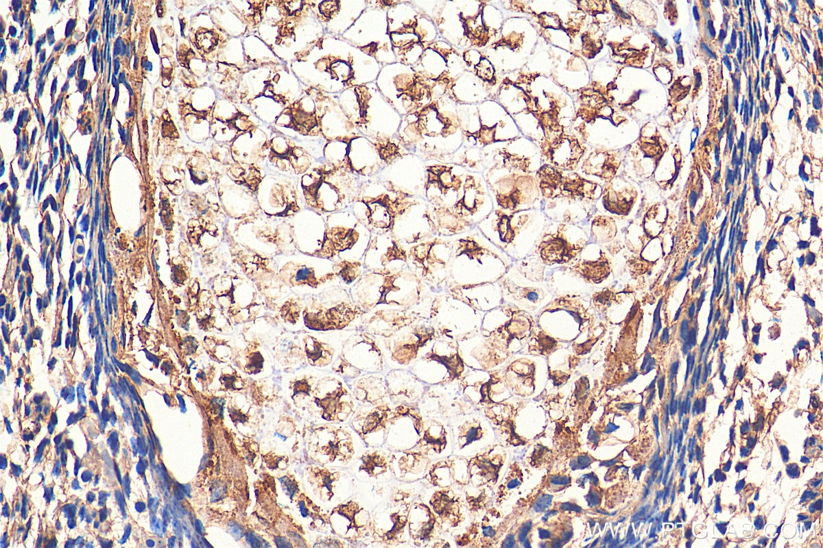 Immunohistochemistry (IHC) staining of mouse embryo tissue using Sclerostin Polyclonal antibody (21933-1-AP)