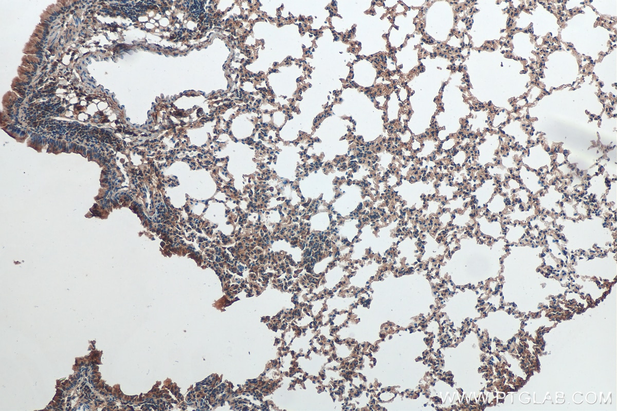 Immunohistochemistry (IHC) staining of mouse lung tissue using Sclerostin Polyclonal antibody (21933-1-AP)