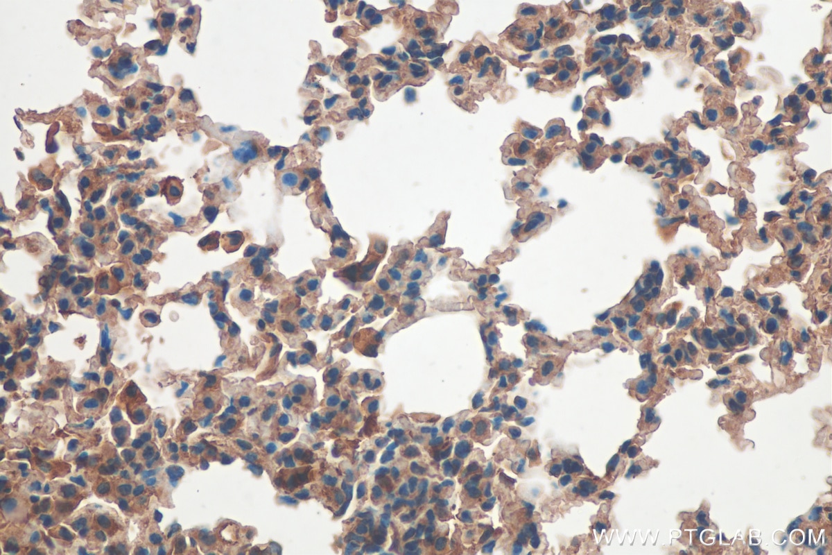 IHC staining of mouse lung using 21933-1-AP