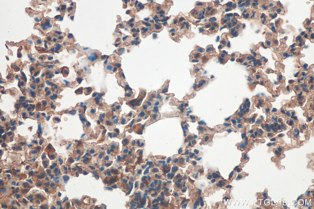 Immunohistochemistry (IHC) staining of mouse lung tissue using Sclerostin Polyclonal antibody (21933-1-AP)