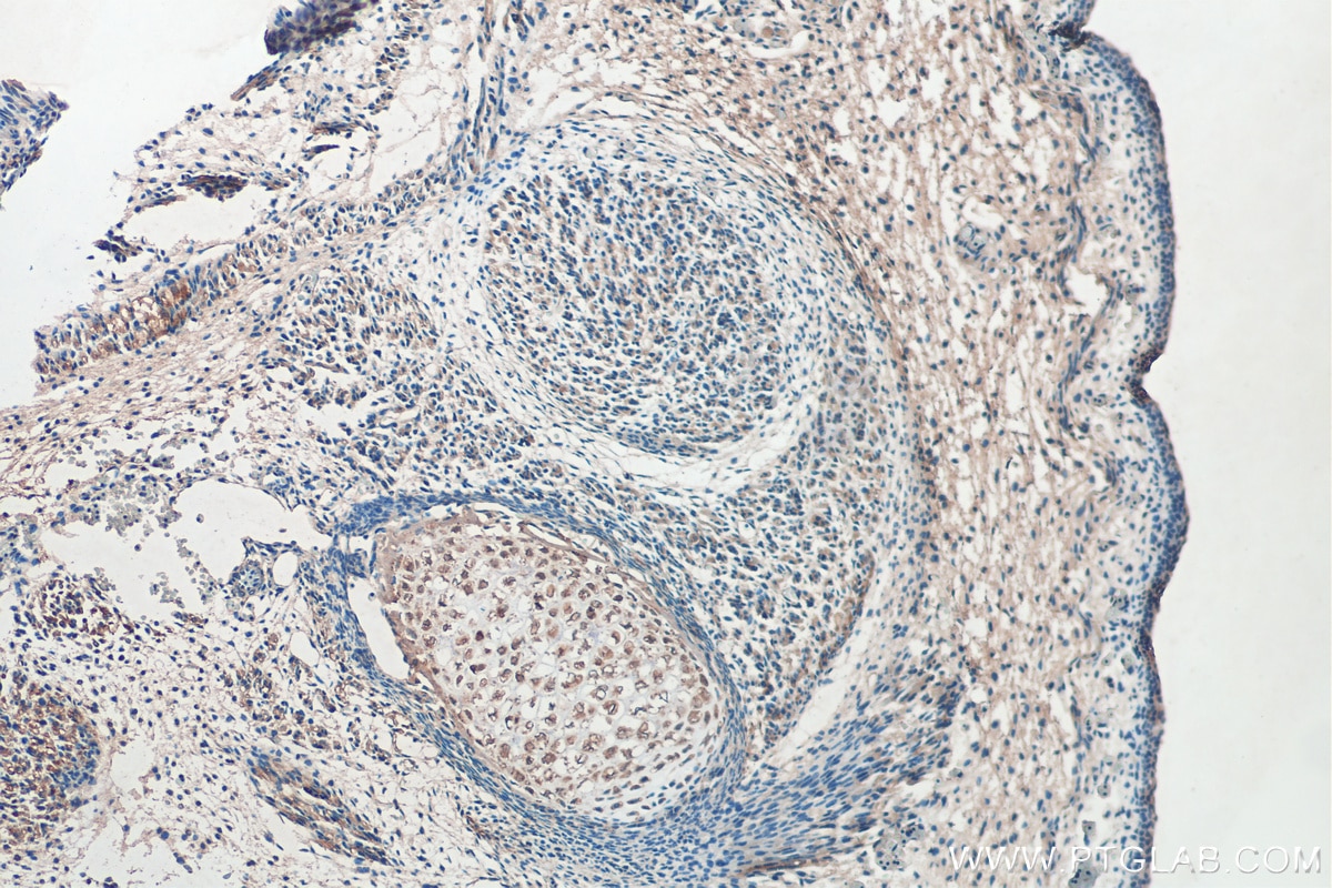Immunohistochemistry (IHC) staining of mouse embryo tissue using Sclerostin Polyclonal antibody (21933-1-AP)